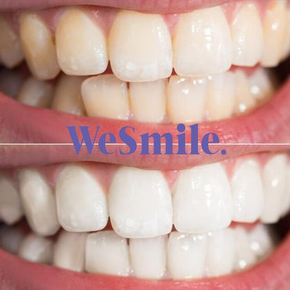 Dentifrice en Or 24k Menthe poivrée ✨