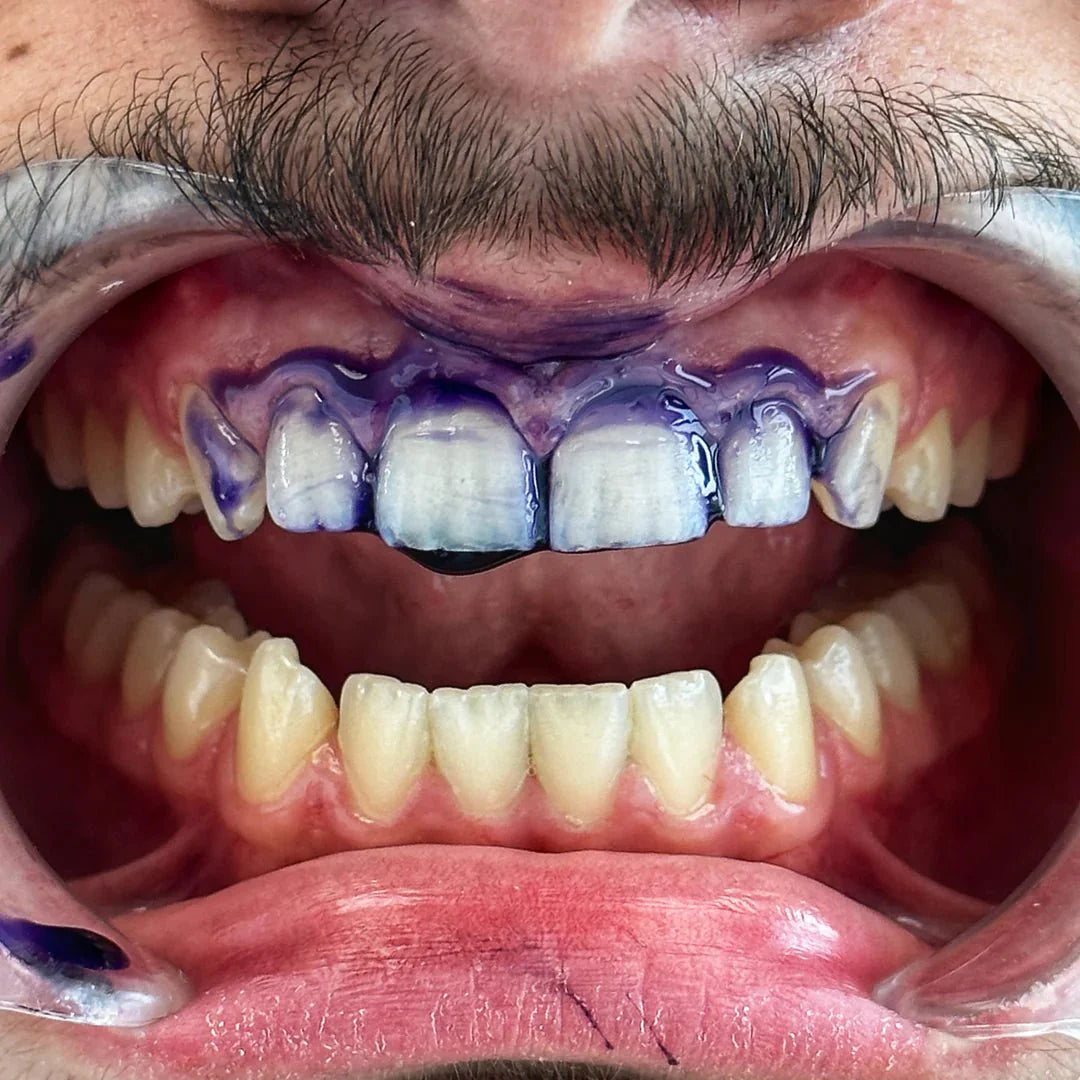 Pack Exclusive WeSmile